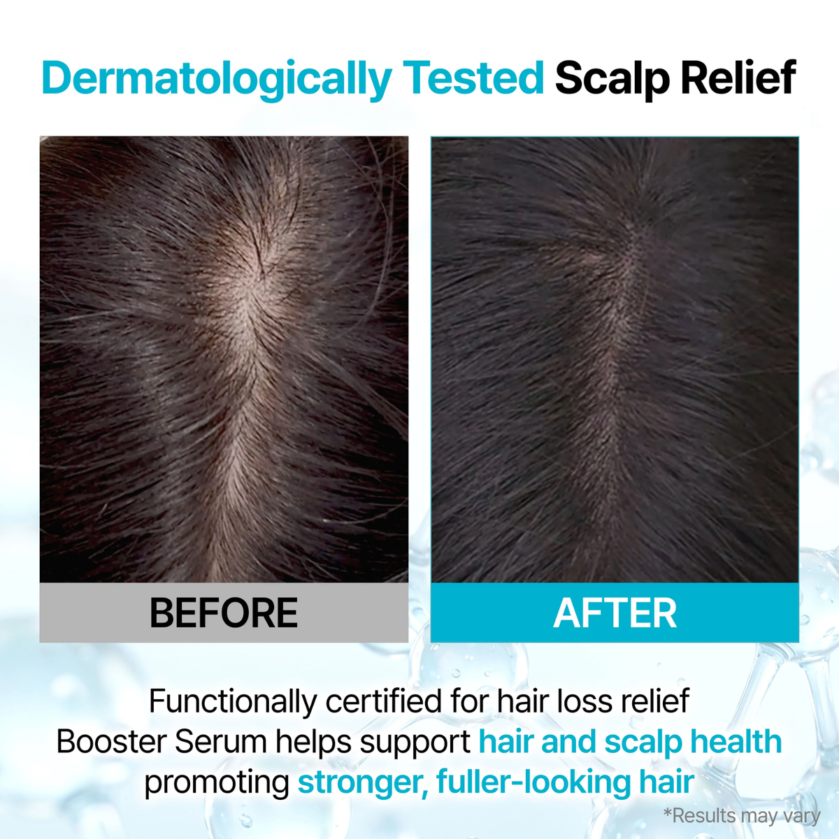 GROWUS Recover Therapy Hair Booster Serum 15ml
