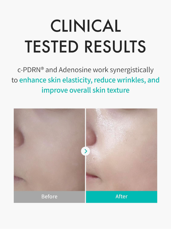 Rejuran Turnover Mask 40ml